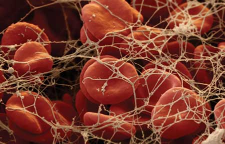 Sel darah merah dan platelet